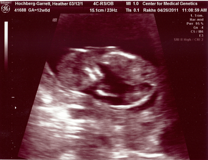 12 weeks pregnant. pictures of 12 weeks pregnant. 12 weeks pregnant.